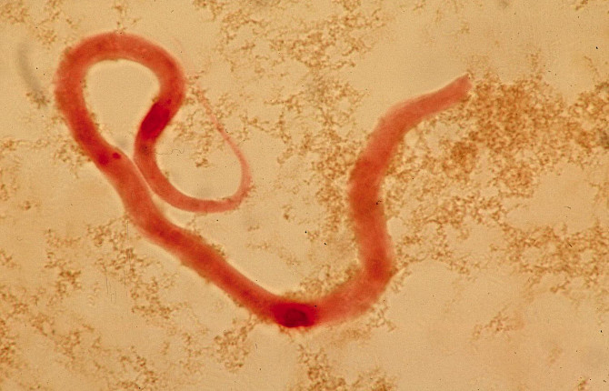 Copilul ranit în PMB cărat în brațe de tatăl său.